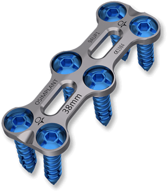 AURA PEEK Interbody Cage
