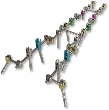 JUVE Pediatric Spinal System