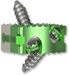 TITANOPEEK Spinal Deformity System